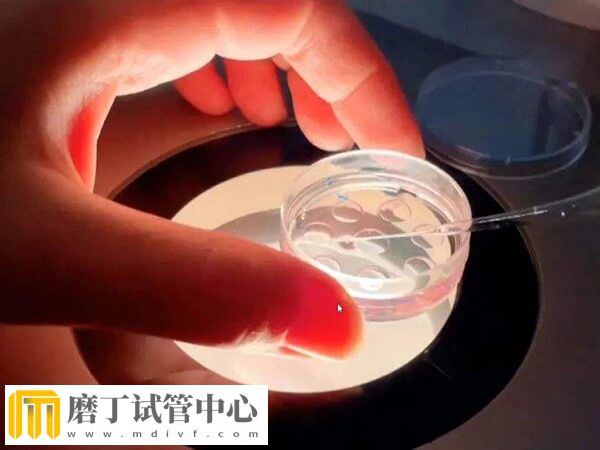 做试管胚胎是如何移植的(图2)