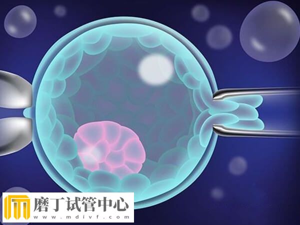 自然周期冻胚移植前要做什么检查(图1) 自然周期冻胚移植前要做什么检查(图1)