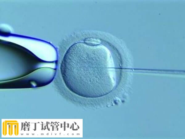 试管婴儿的各种方案有哪些(图1) 试管婴儿的各种方案有哪些(图1)